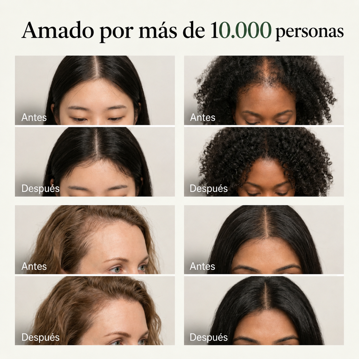Yoracare · Barra Coreana · Apoya el crecimiento para un pelo sano y fuerte